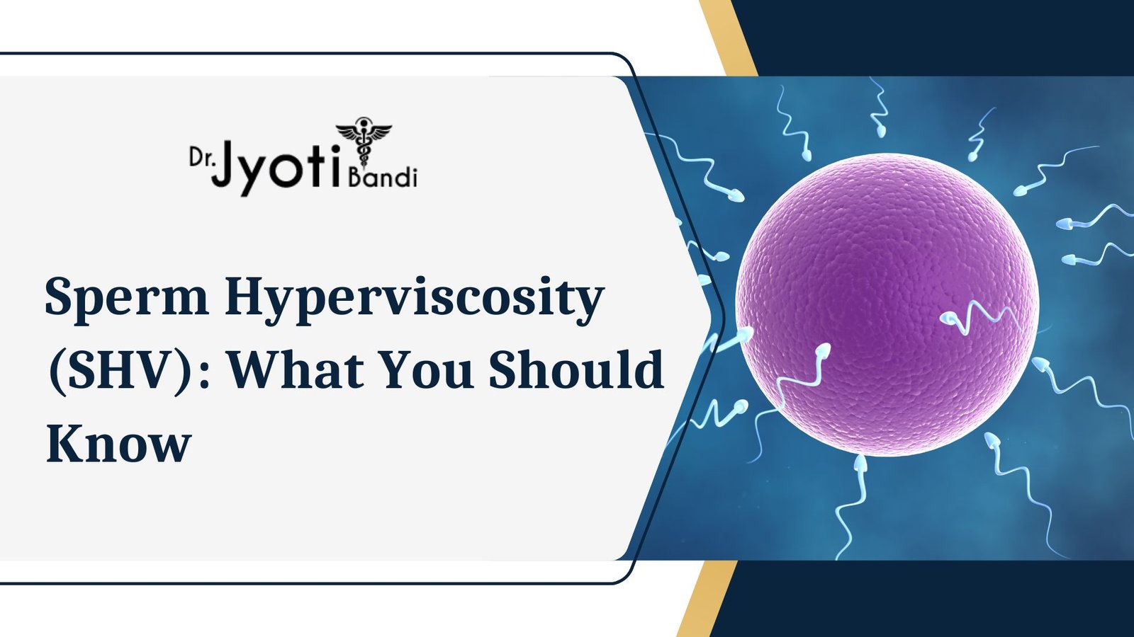 Sperm Hyperviscosity (SHV): What You Should Know