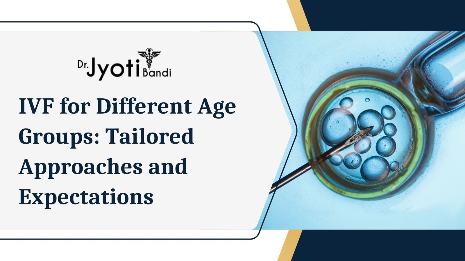 IVF for Different Age Groups: Tailored Approaches and Expectations