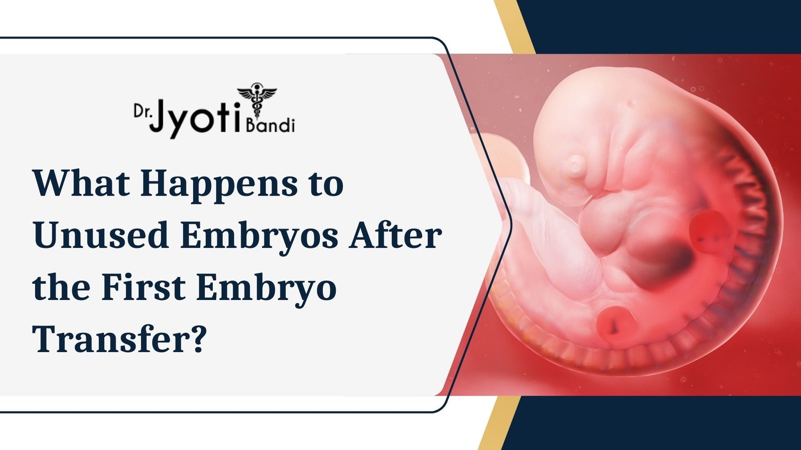 What Happens to Unused Embryos After the First Embryo Transfer? | Dr. Jyoti Bandi Explains