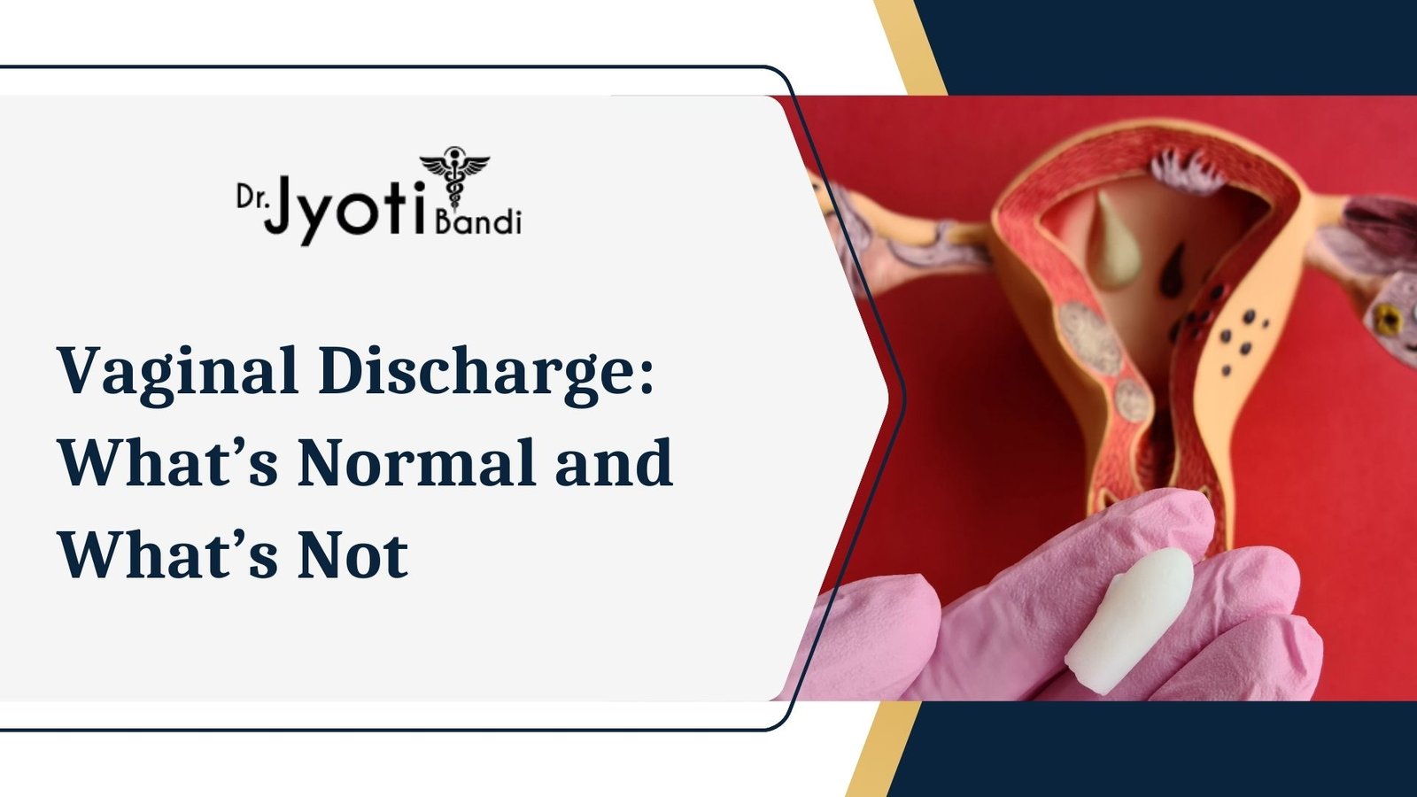 Vaginal Discharge: What’s Normal and What’s Not
