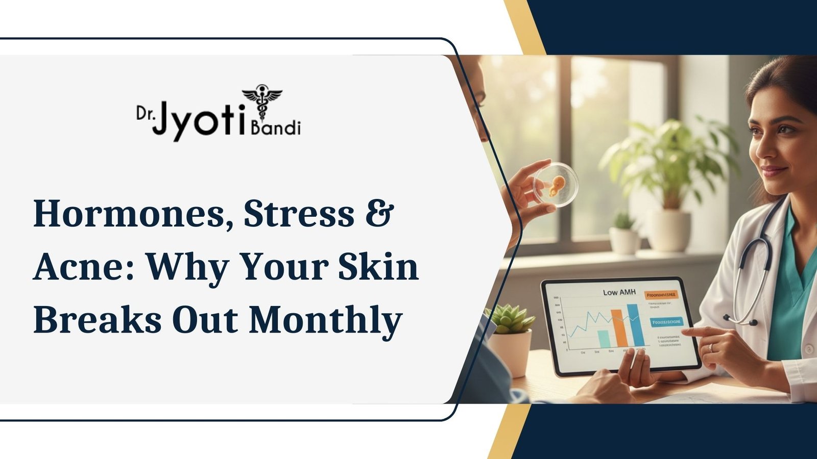 Hormones, Stress & Acne: Why Your Skin Breaks Out Monthly