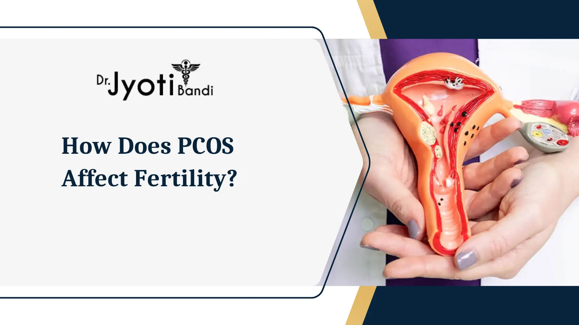 How Does PCOS Affect Fertility? | Dr. Jyoti Bandi Explains | Best IVF Specialist in HSR Layout